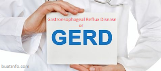 Buat Info - Gastroesophageal Reflux Disease (GERD)