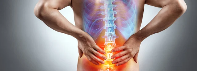 10 Home Remedies To Manage Sciatica + Prevention Tips