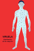 viruela