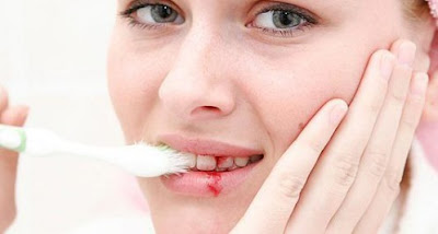 Các bệnh về răng miệng