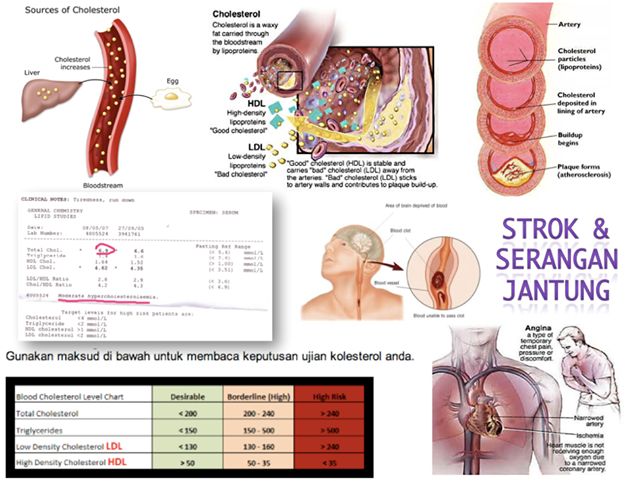 Dari Semua Untuk Semua Kepada Semua KESIHATAN Kolestrol 