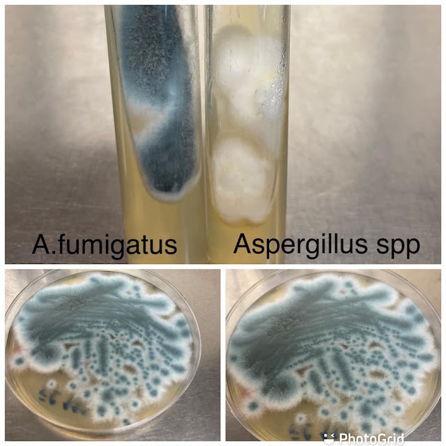 aspergillus fumigatus