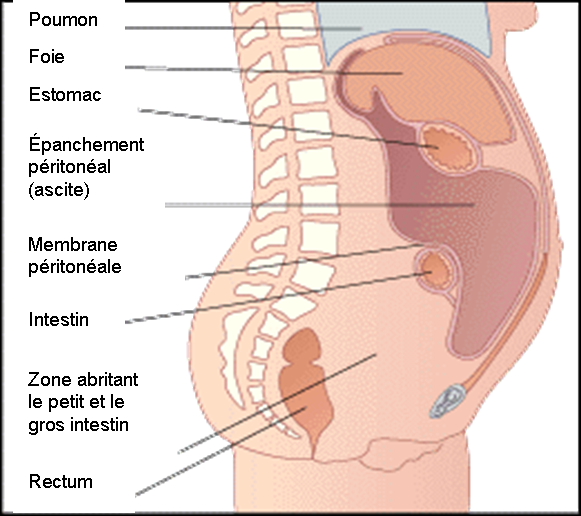 Actualités Scientifiques - Médicales: Aflibercept administré par ...