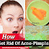 Overnight Acne And Pimples Removal