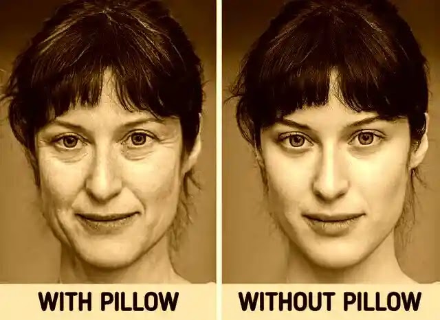 What is pillow face?