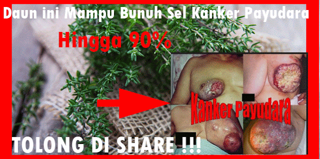 Luar Biasa!! Minyak Ekstrak Daun ini Bunuh Sel Kanker Payudara Hingga 90% ! Tolong Bagikan Agar Lebih Bermanfaat...