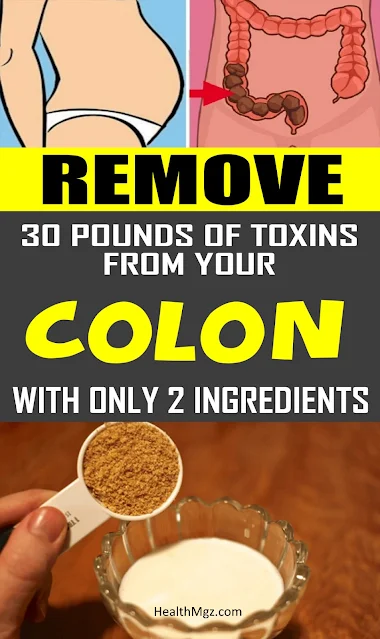 Remove 30 Pounds of Toxins From Your Colon With Only 2 Ingredients