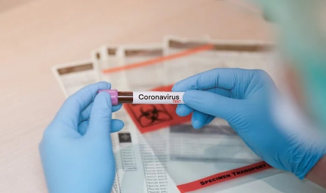 Teste do coronavírus em Petrópolis