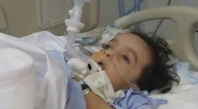Child dies after Corona Virus test Swab breaks in his Nose