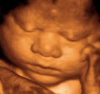 3d Ultrasound Pictures Pregnancy3