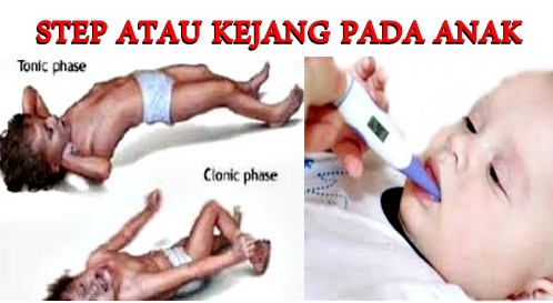 Orang Tua Wajib Tahu !!! Inilah Cara Mengatasi Step / Stuip / Kejang Demam Pada Bayi Dan Balita.!! Bantu Share Ya Agar Lebih Bermanfaat.!!