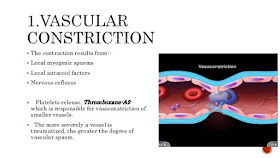   vascular spasm, vascular spasm brain, venous spasm signs and symptoms, vascular spasm eye, vascular spasm function, vascular spasms in legs, vascular spasm migraine, vascular spasm in the head, brain spasm causes