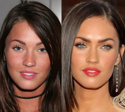 megan fox plastic surgery