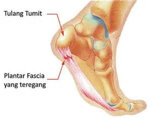 Tips SAKIT KAKI KEMBALI SEMBUH