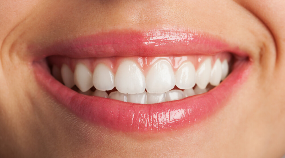 Teeth Whitening Oakleigh South