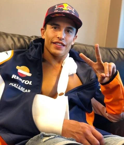 Marc Marquez Cidera Lengan Kanan Atas Jerez 19 Juli 2020