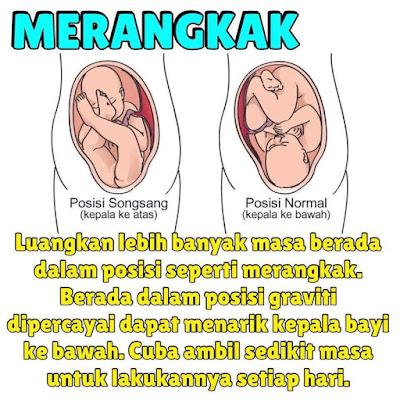 tips kehamilan, cara hindari kelahiran songsang, kelahiran songsang