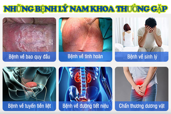 Các bệnh nam khoa thường gặp