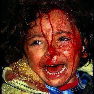 wound child, children in war, Attacks under  Innocent Child, kids, children, Israel-Gaza conflict, war, fight