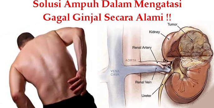 Tips Kesehatan Cara Ampuh Dalam Mengobati Gagal Ginjal Ekstrak Teripang