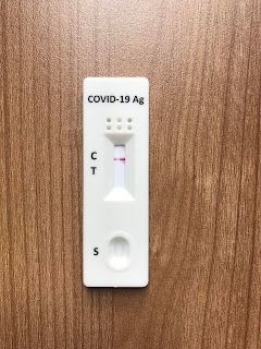 AllTest COVID-19 Antigen Test Kit 使用方法 | AllTest冠状病毒检测结果 | 家里出现疑似COVID-19症状怎么办？ 阳性COVID-19患者如何治疗和休息？