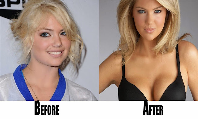 Kate-Upton-without-makeup