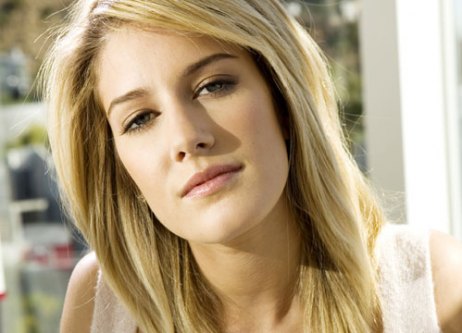 heidi montag plastic surgery face. Heidi Montag - Plastic surgery