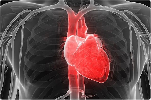 Dilated Cardiomyopathy