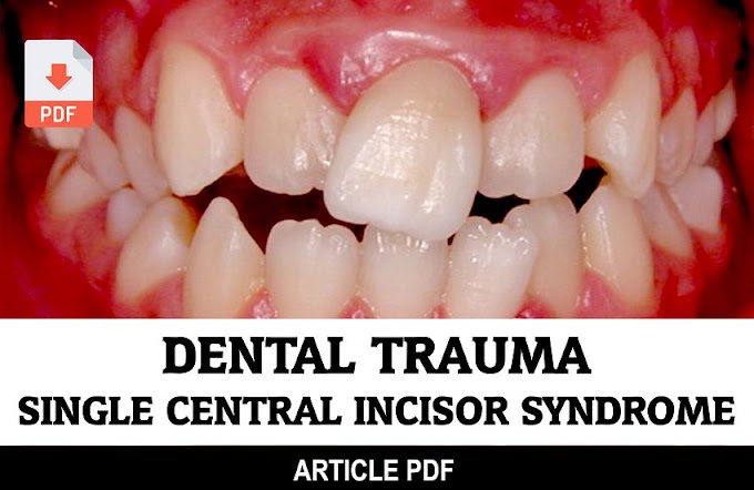 PDF: Dental trauma clinically mimicking single central incisor syndrome