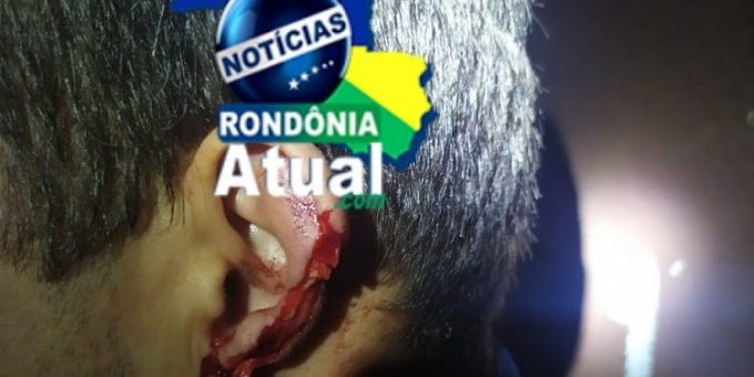 Covarde: Em Ji-Paraná, ex marido invade residência, arranca pedaço do nariz e orelha do atual namorado de sua ex