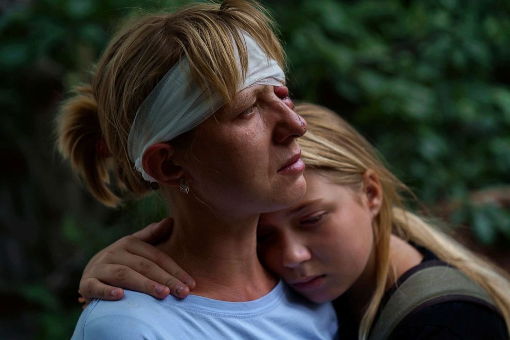 Nelia Fedorova, left, is embraced by her little girl, Yelyzaveta Gavenko, 11, as they visit a neighbor's home where somebody was killed in a Russian rocket assault Friday night which likewise harmed Federova, in Kramatorsk, Donetsk locale, eastern Ukraine, Aug. 13, 2022. The strike killed three individuals and injured 13 others, as indicated by the city chairman.