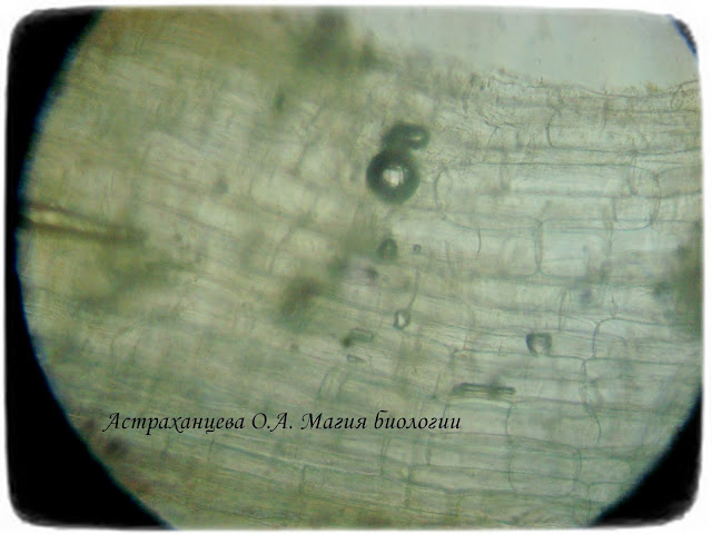 КОАПП_почему в одуванчике молоко_магия биологии, одуванчик под микроскопом