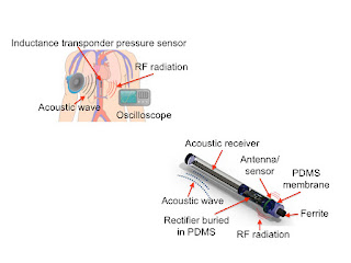 New type of miniature medical sensor powered by acoustic waves