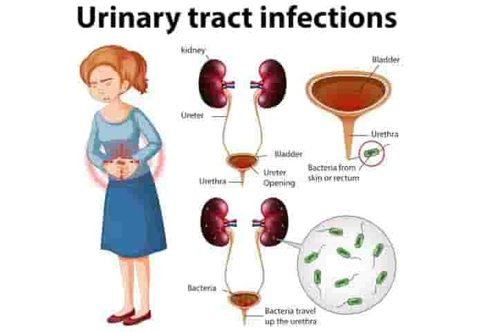 News, Top-Headlines, News, News-Malayalam-News, National, National-News, Health, Health-News, Lifestyle, Lifestyle-News, How dangerous is urinary tract infection?.