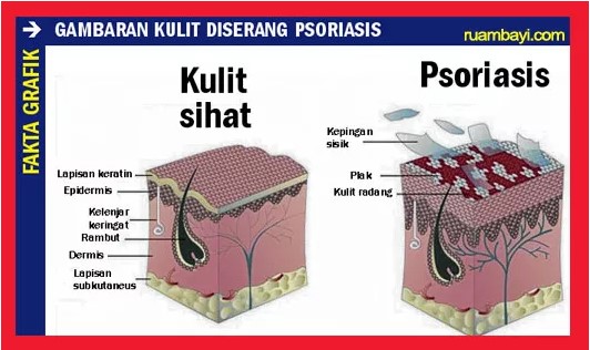 MENAKJUBKANCubalah!! cara dan kaedah paling senang dan 