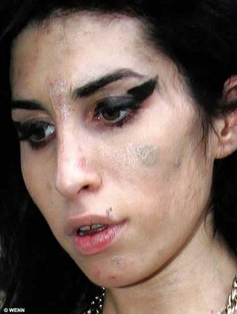 Anche Lady Gaga soffre della sindrome di morgellons? Anche Lady Gaga soffre della sindrome di morgellons?