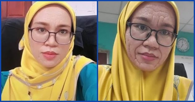 Wajah Ibu Muda Berubah Menua Seperti Nenek-Nenek Setelah Melahirkan, Begini Nasibnya Setelah Dengar Diagnosa Dokter