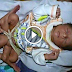 Surorising Baby Born In Karachi Pakistan