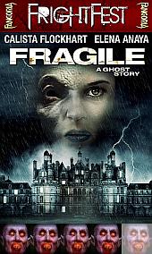Fragile B Fragile B
