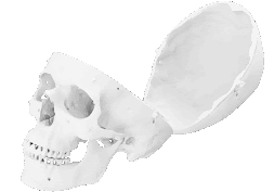 A human skull with the cap removed but still in frame