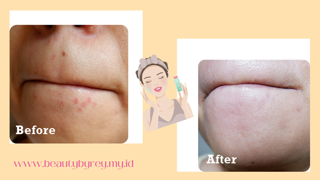 skintific barrier booster facial oil foto before after