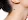 10 Remedies To Remove Skin Tags