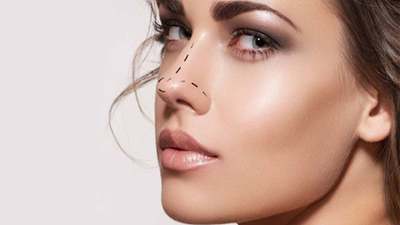 Important Facts Related To Rhinoplasty One Must Know