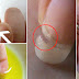 Attention! Don't Worry If Your Nails Look Fragile And Brittle, See This Below!