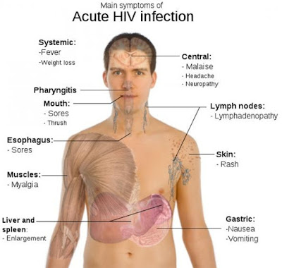 Acute HIV Infection