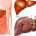 Những điểu cẩn chú ý đối với việc ăn uống của người bị bệnh viêm gan do virus kèm theo gan nhiễm mỡ