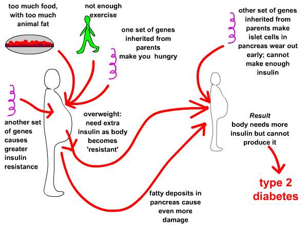 causes of  type 1