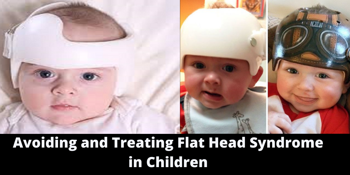 Avoiding and Treating Flat Head Syndrome in Children