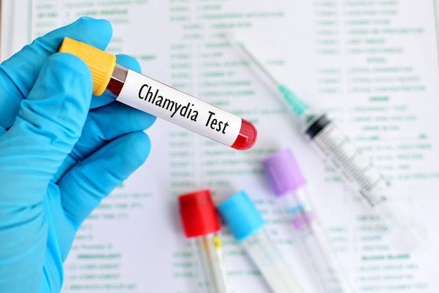 Chlamydia