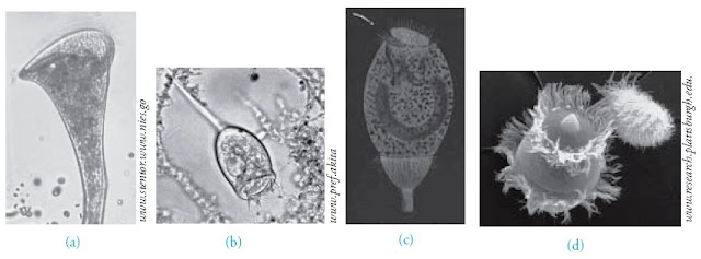 Stentor Vorticella Stylonichia Didinium